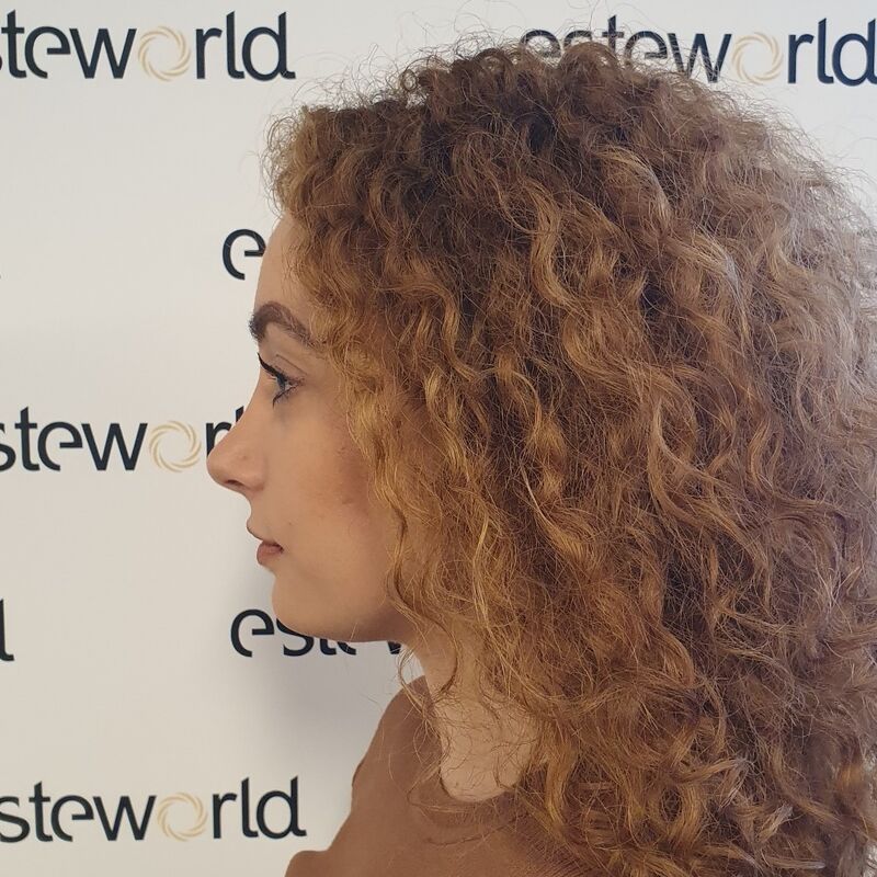 Betul super blij met neuscorrectie