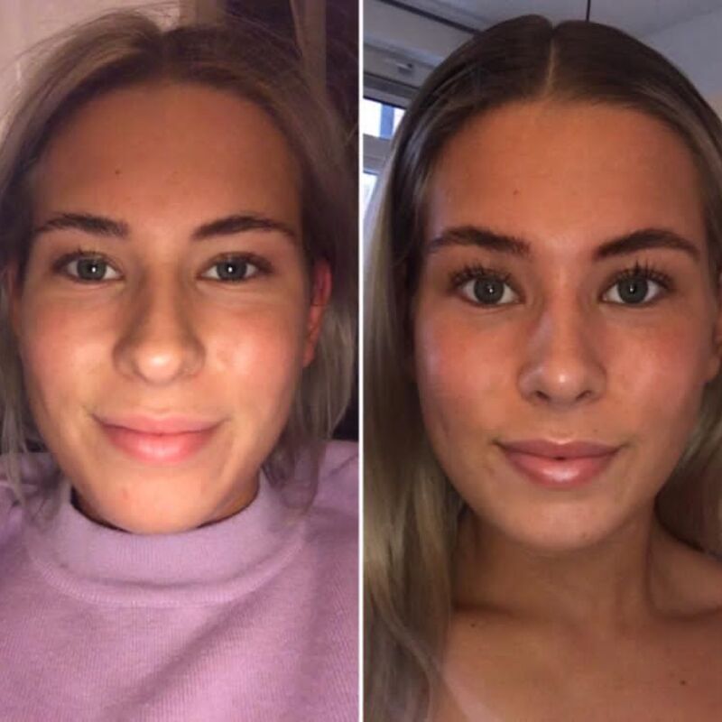 Beste keuze ooit geweest! Blij met mijn Neus!