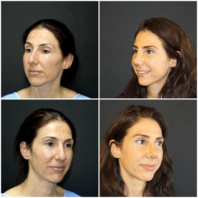 Zeer fijn gevoel bij Esteworld, vertrouwd en professioneel