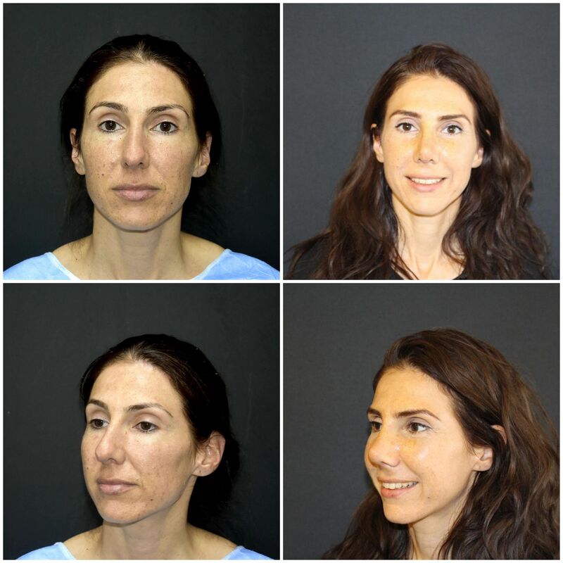 Zeer fijn gevoel bij Esteworld, vertrouwd en professioneel