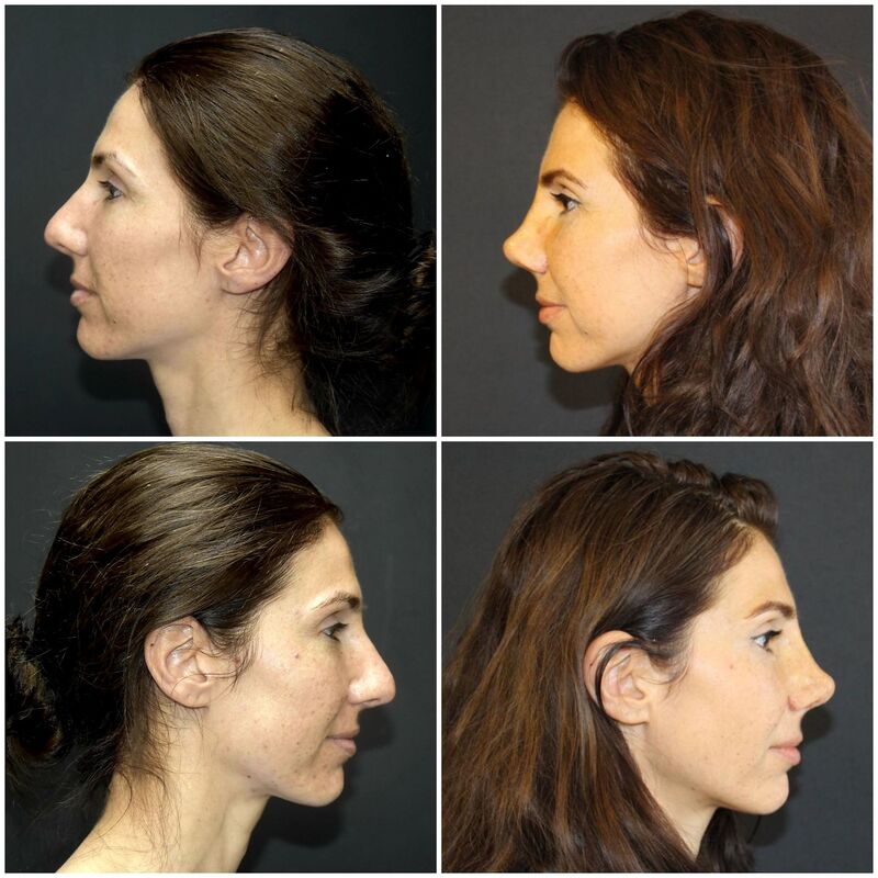 Zeer fijn gevoel bij Esteworld, vertrouwd en professioneel