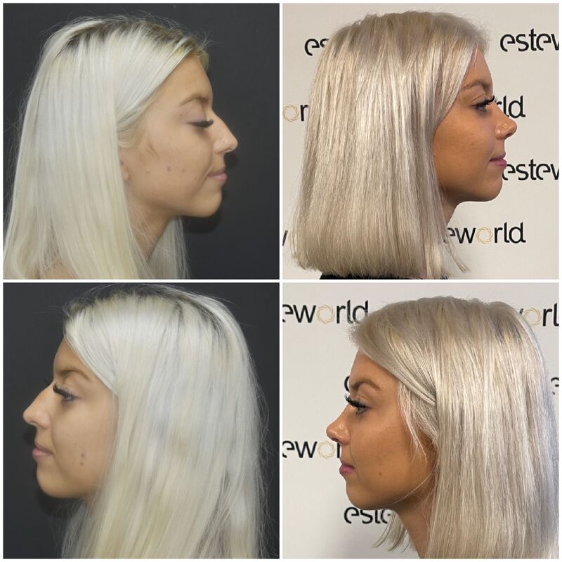 Bieke, neusje van de zalm!