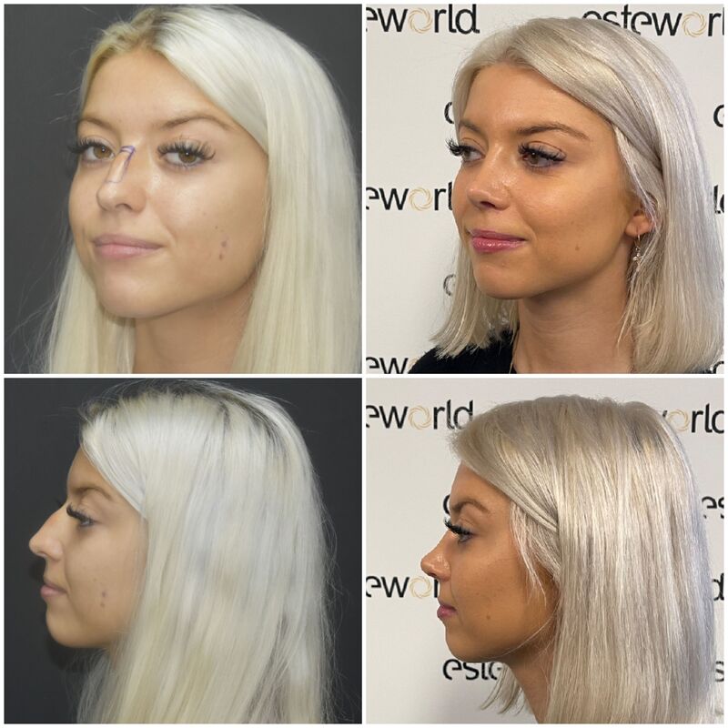 Bieke, neusje van de zalm!