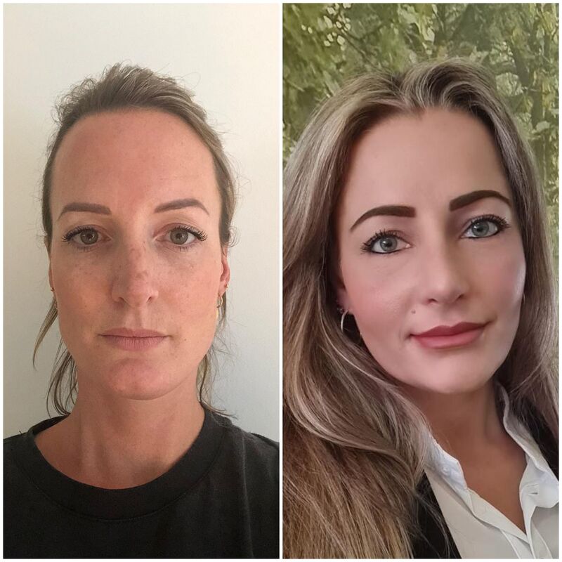 Esteworld bedankt voor mijn nieuwe neus!