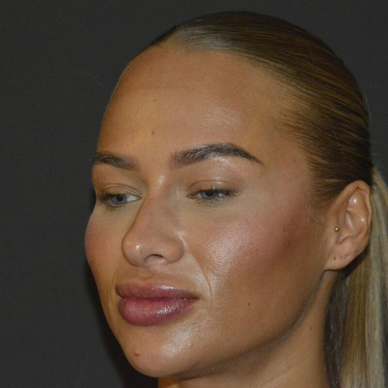 @Annebelvisscher influencer Neuscorrectie Turkije