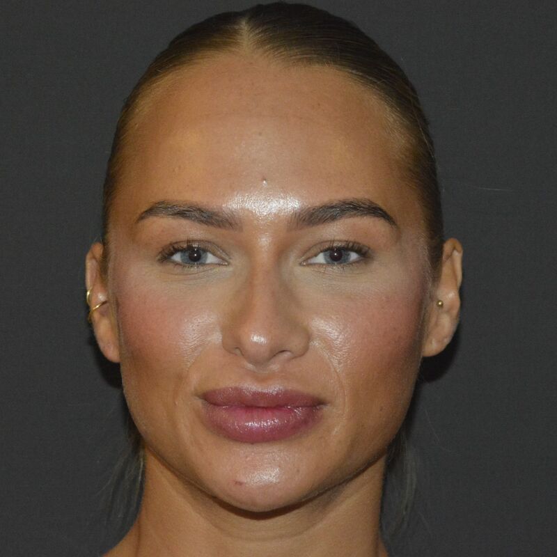 @Annebelvisscher influencer Neuscorrectie Turkije