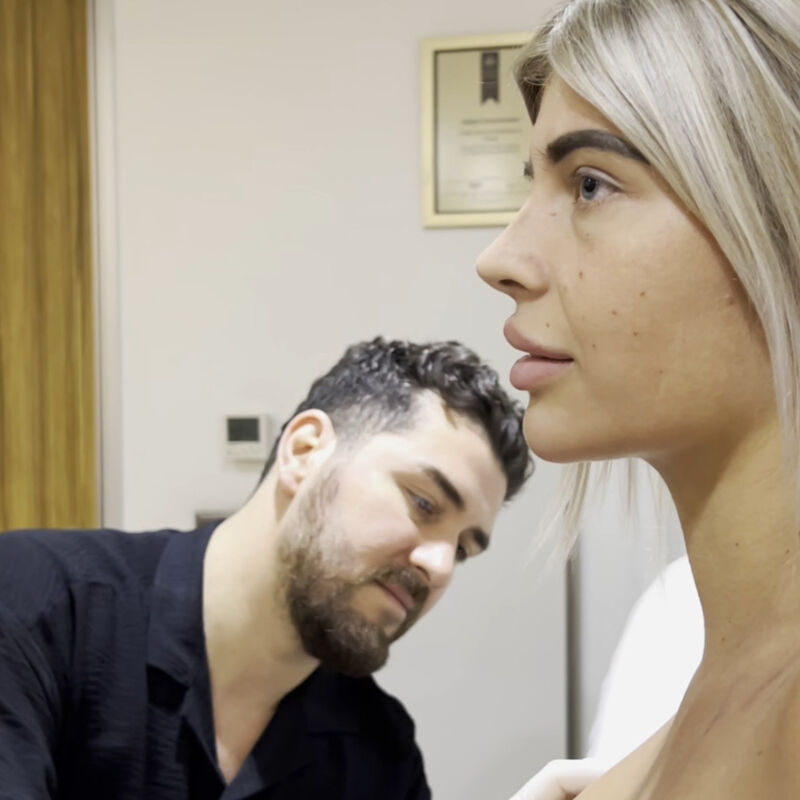 @Shanikevh borstlift met slappe huid maar groot resultaat