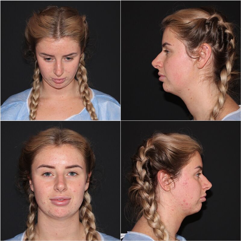 Influencer @cleoxevie. Echt mijn droom neusje! 