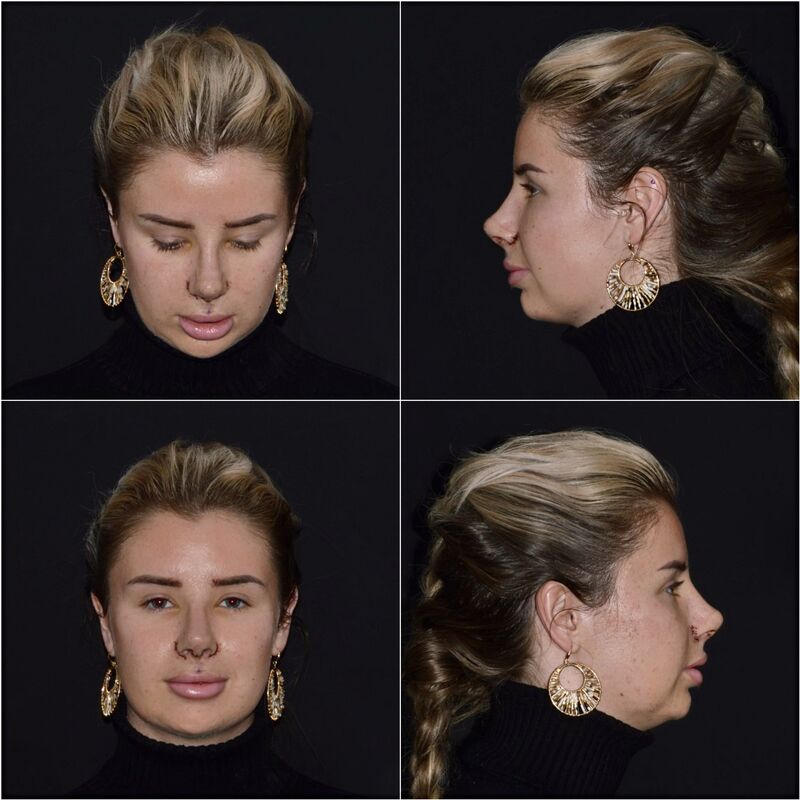 Influencer @cleoxevie. Echt mijn droom neusje! 