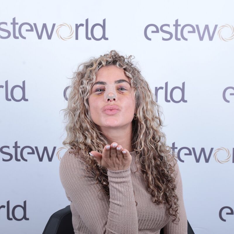 Playmate en Influencer Nena Vlaar haar neuscorrectie