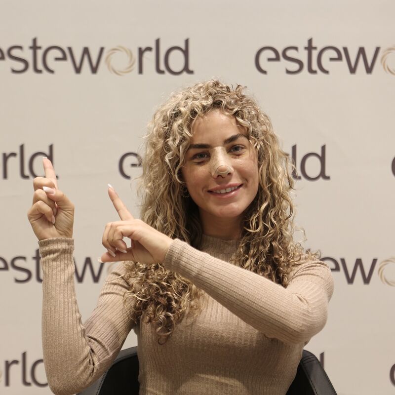 Playmate en Influencer Nena Vlaar haar neuscorrectie