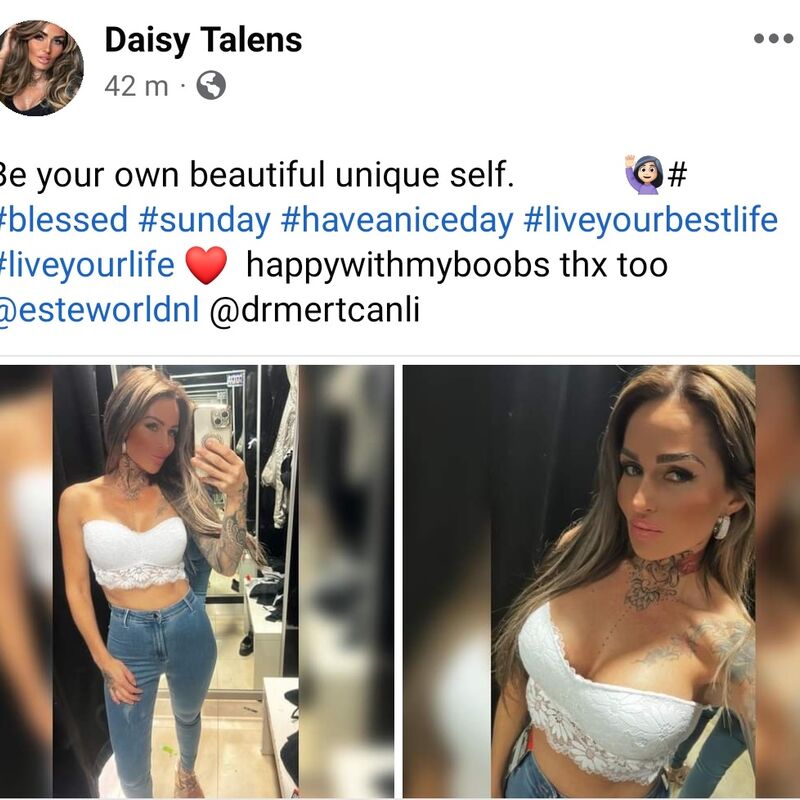 Zangeres Daisy Talens borstvergroting @ Esteworld