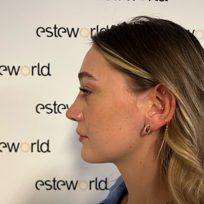 Ik droomde al van een neuscorrectie