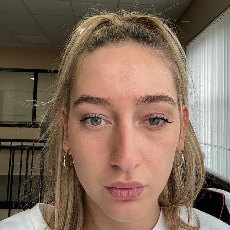 Ik droomde al van een neuscorrectie