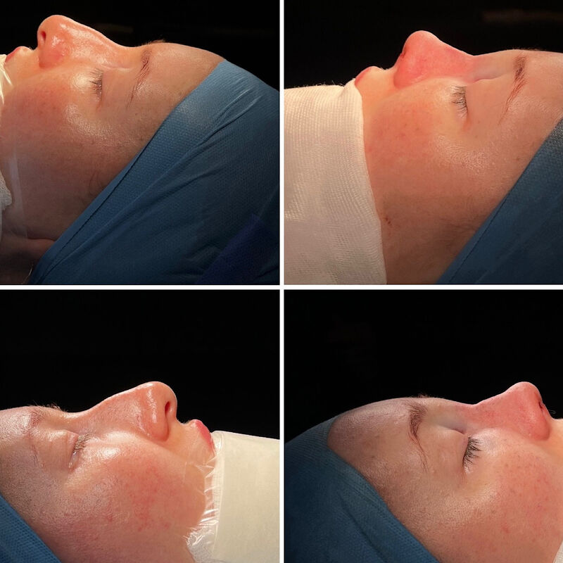 Neuscorrectie van @Eslunalove