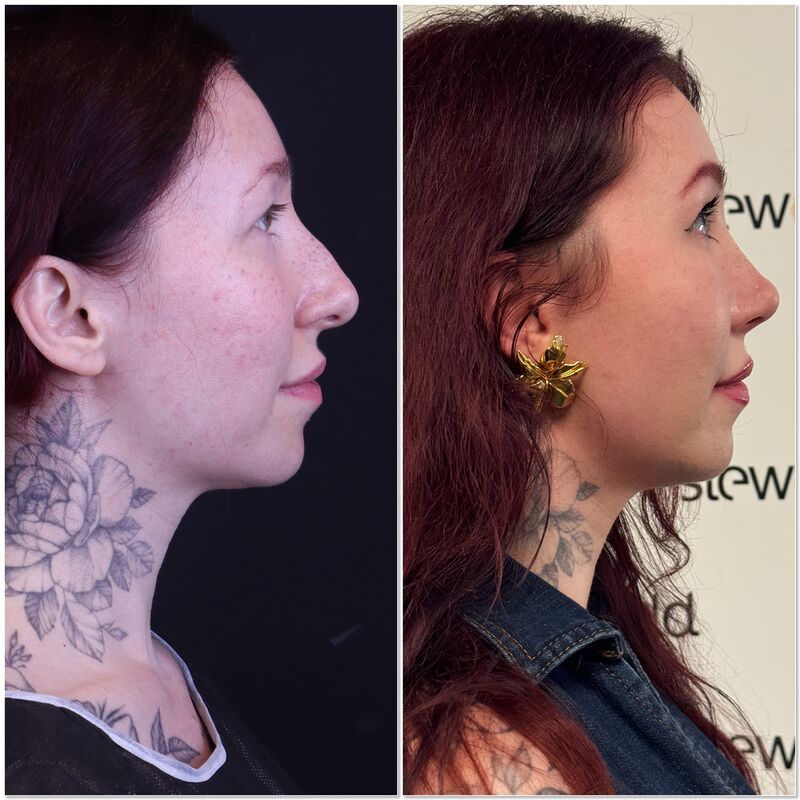 Neuscorrectie van @Eslunalove