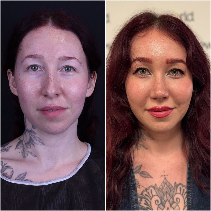 Neuscorrectie van @Eslunalove