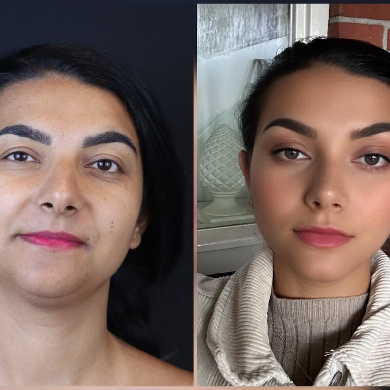 Neus en borstcorrectie voor Nicole