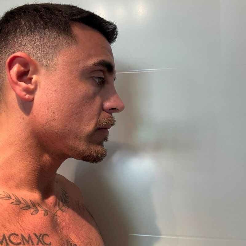 Martin, een neuscorrectie wilde ik al zo lang