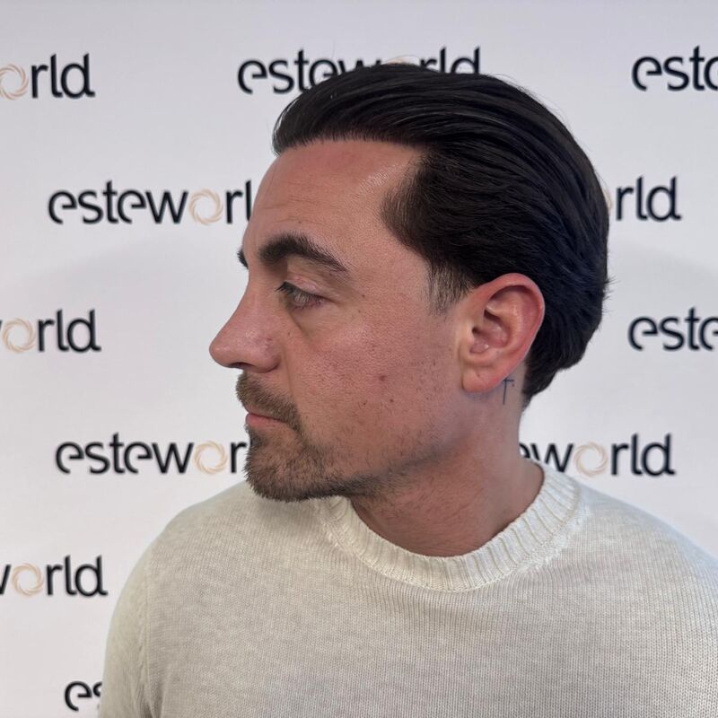 Martin, een neuscorrectie wilde ik al zo lang