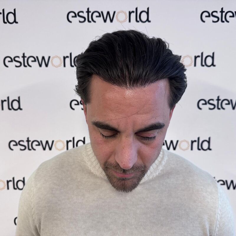 Martin, een neuscorrectie wilde ik al zo lang