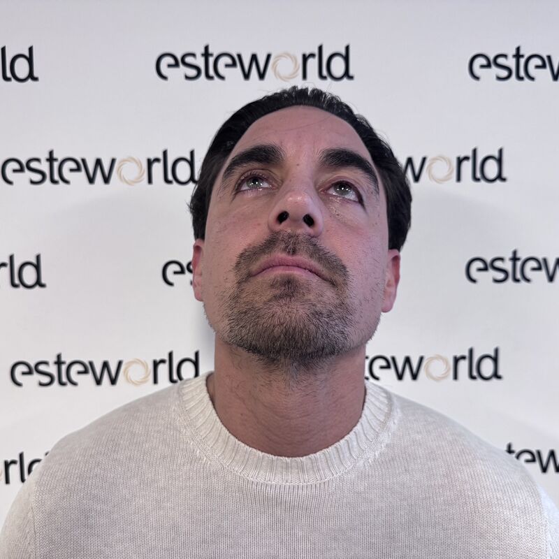 Martin, een neuscorrectie wilde ik al zo lang