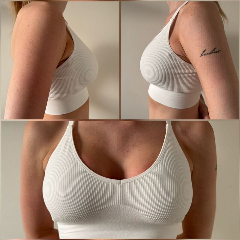 Marilena, waarom Esteworld voor mijn Neus en borsten?