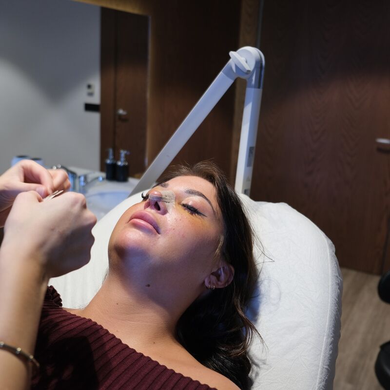 Zoe Bosch, een neuscorrectie stond op mijn wenslijstje