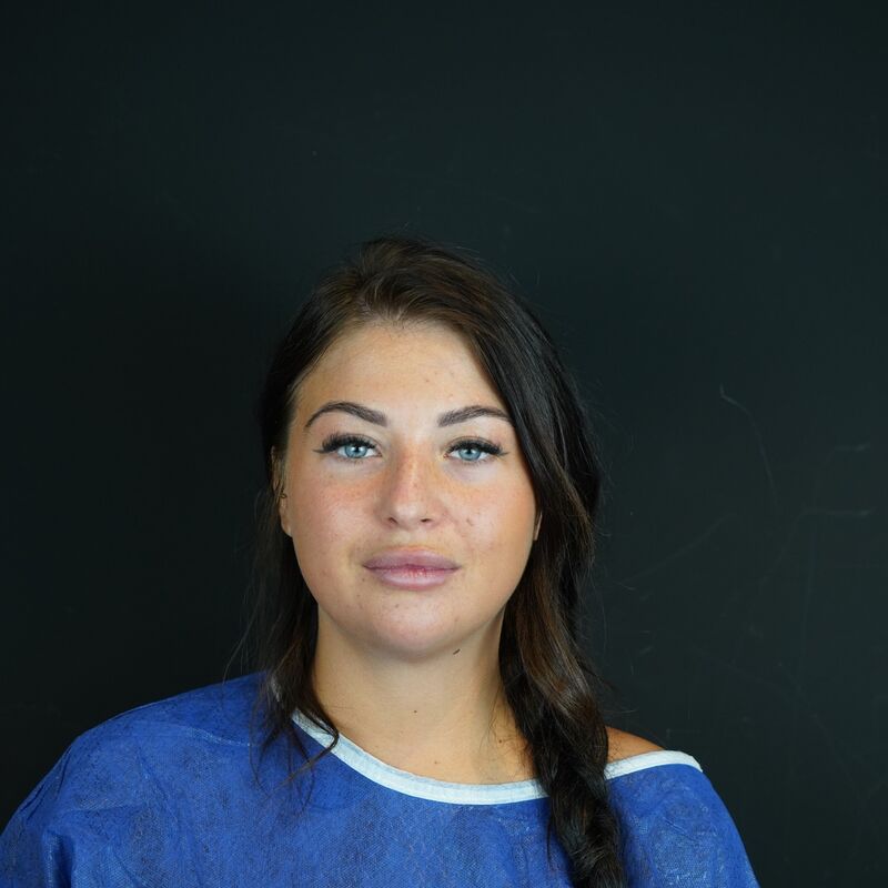 Zoe Bosch, een neuscorrectie stond op mijn wenslijstje