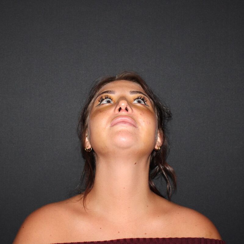 Zoe Bosch, een neuscorrectie stond op mijn wenslijstje