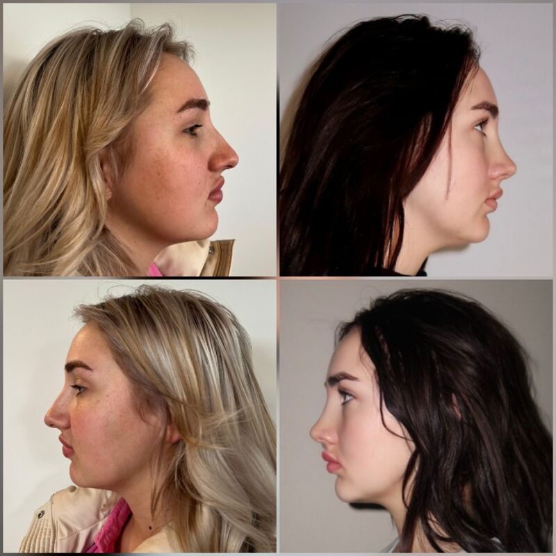 Janey, geen makkelijke beslissing maar zo blij nu!