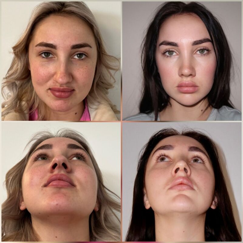 Janey, geen makkelijke beslissing maar zo blij nu!