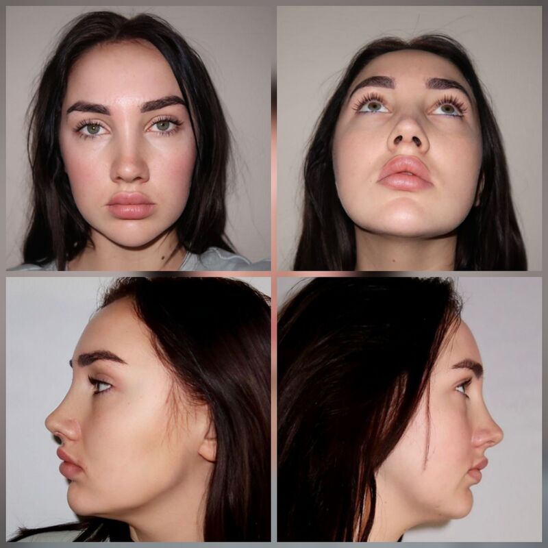 Janey, geen makkelijke beslissing maar zo blij nu!