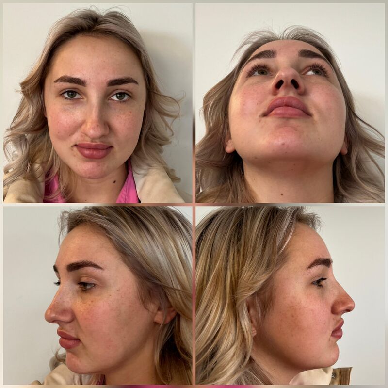 Janey, geen makkelijke beslissing maar zo blij nu!