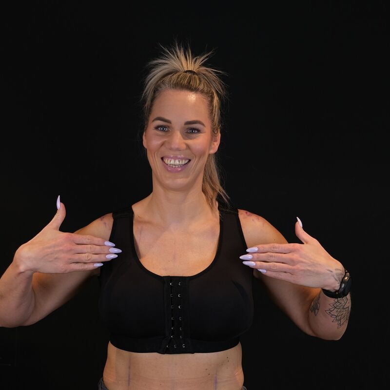 Borstlift plus prothese na 2 mislukte behandelingen in NL