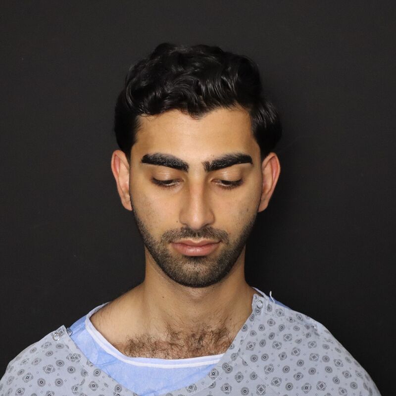 Alireza, mijn neus past nu perfect bij mijn gezicht