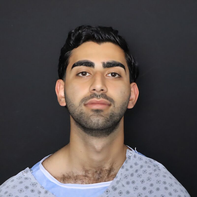 Alireza, mijn neus past nu perfect bij mijn gezicht