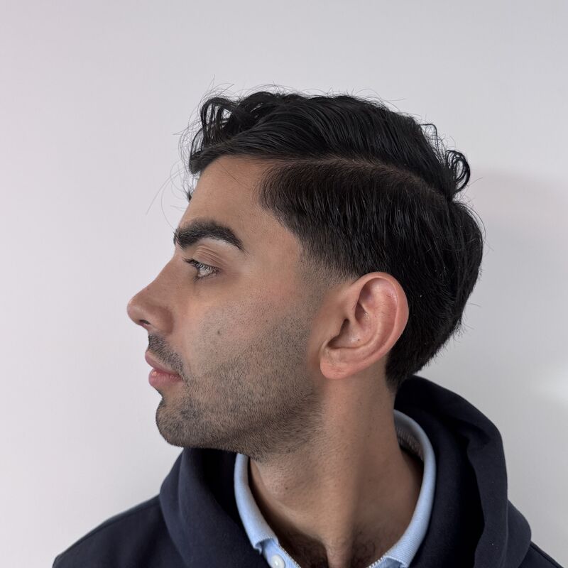 Alireza, mijn neus past nu perfect bij mijn gezicht