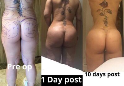 Braziliaanse bilvergroting Turkije