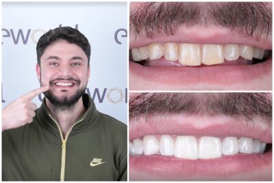 Tandarts in Turkije: waarom Esteworld een goede keuze is