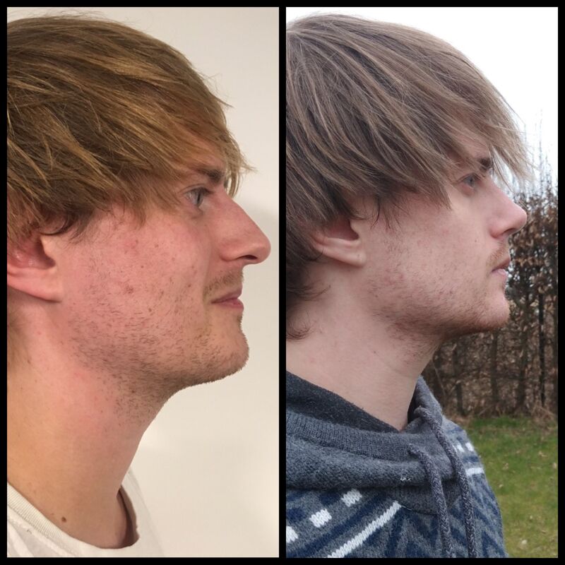 Mijn neus ziet er fantastisch uit