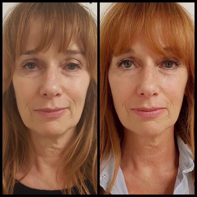 BN'er Patty Zomer (dolly dots) bij Esteworld