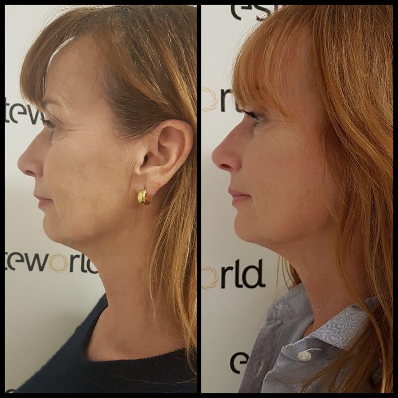 BN'er Patty Zomer (dolly dots) bij Esteworld