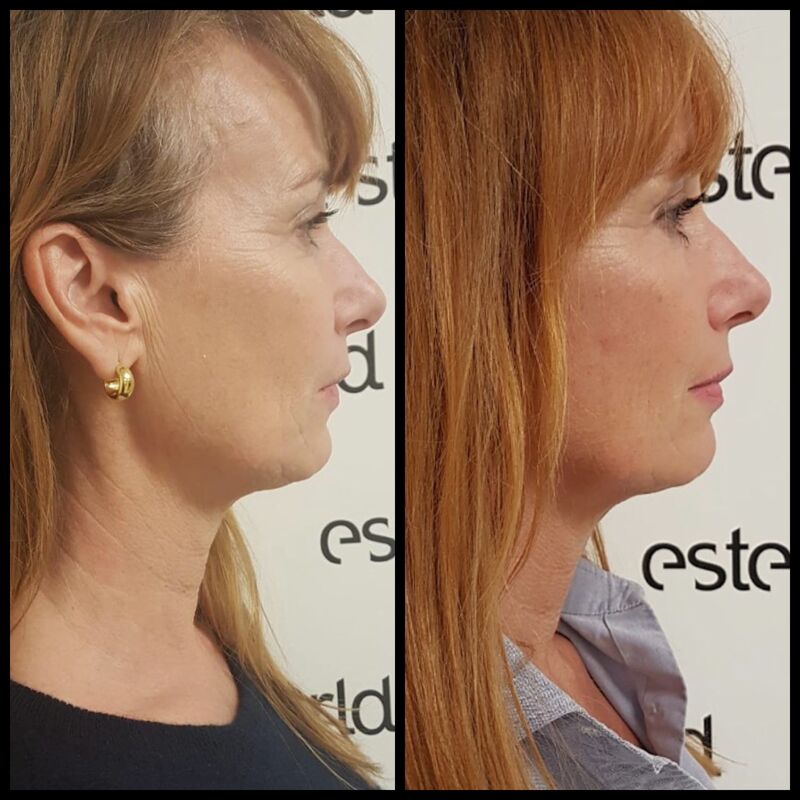 BN'er Patty Zomer (dolly dots) bij Esteworld