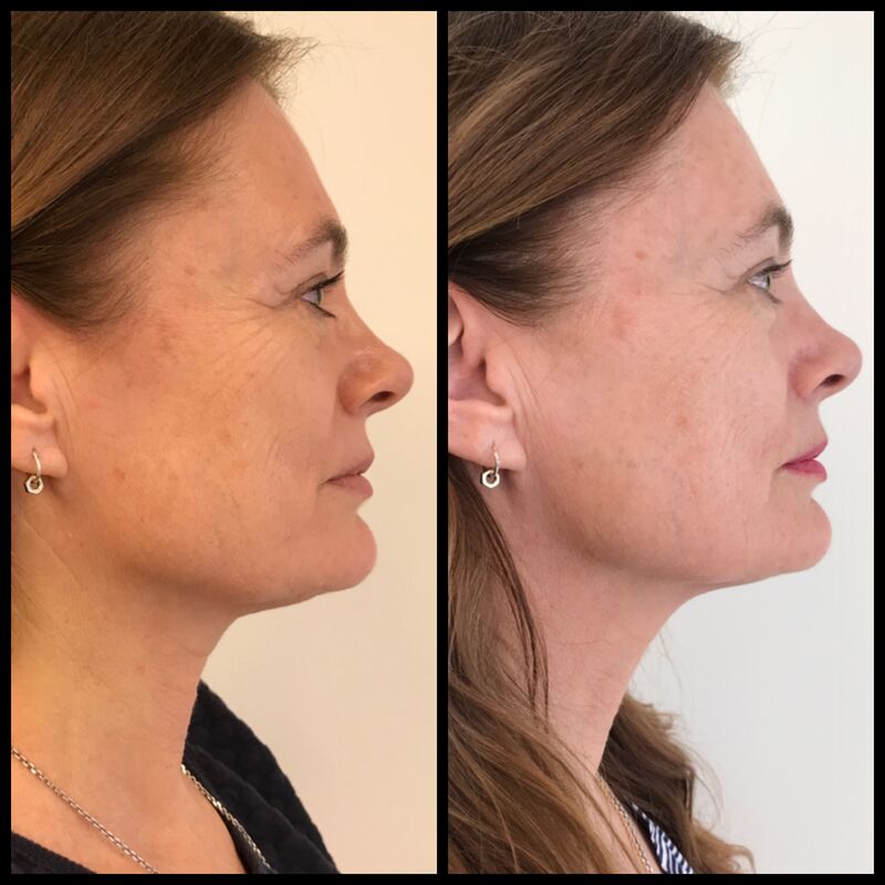 BN'er Lydia le Loux bij Estewold