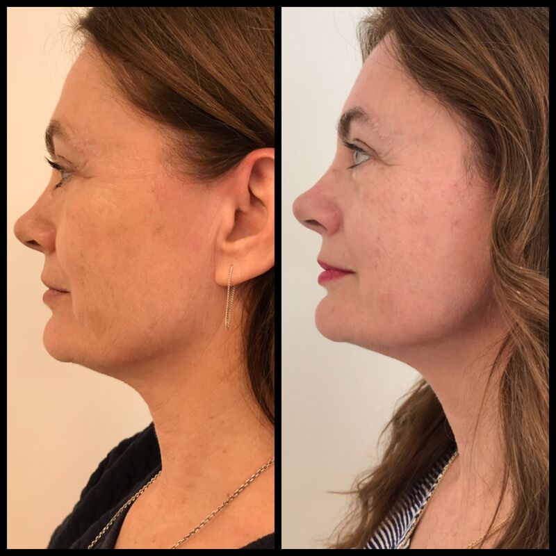 BN'er Lydia le Loux bij Estewold