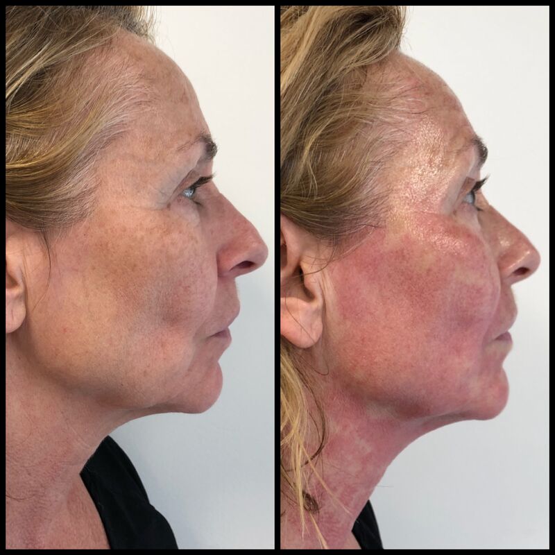 Angela Groothuizen bij Esteworld