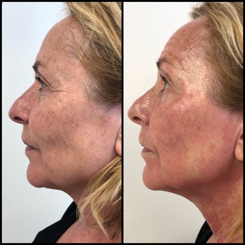 Angela Groothuizen bij Esteworld