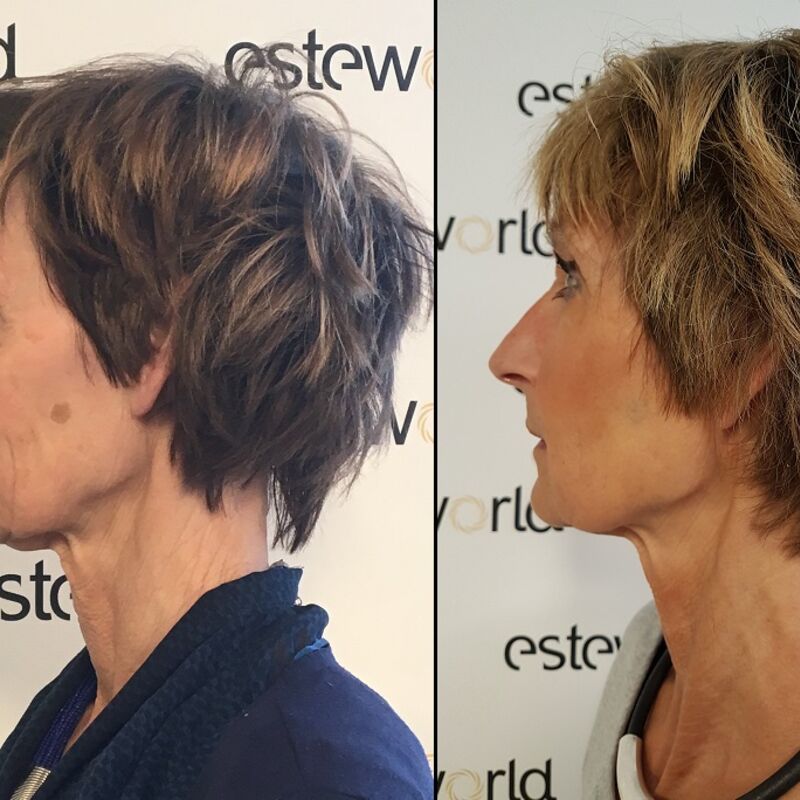 Esteworld heeft mijn leven veranderd