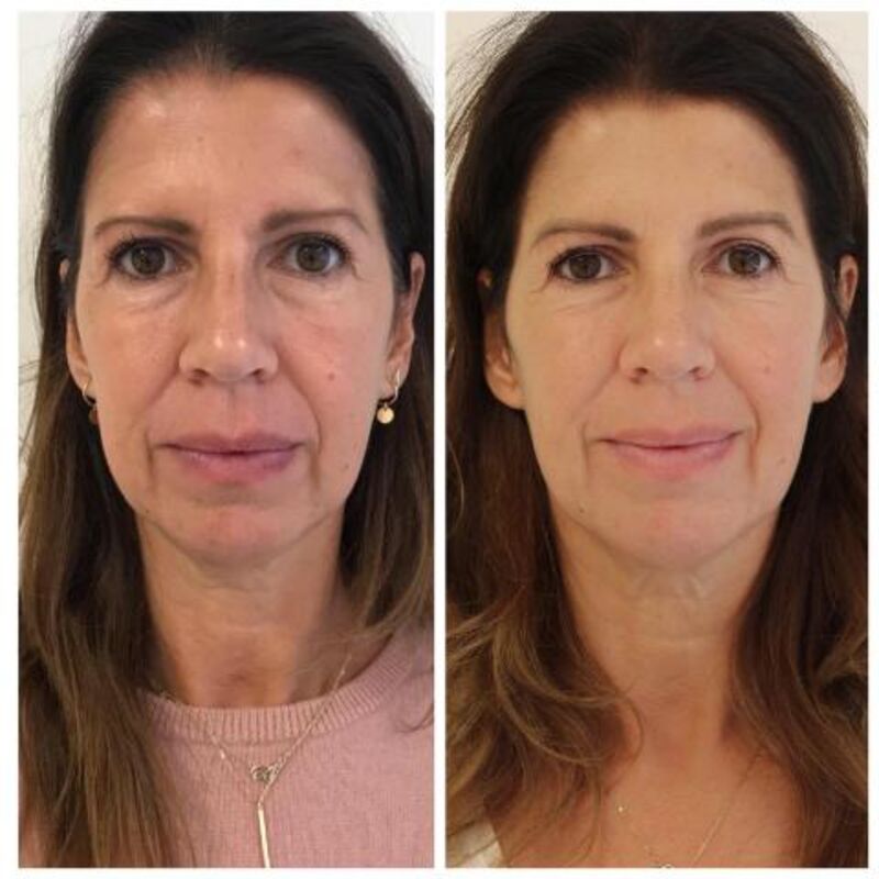 Isa Hoes Jaren Jonger